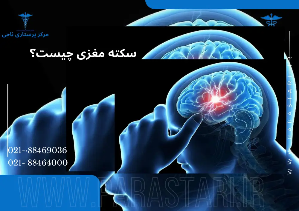 سکته مغزی چیست؟